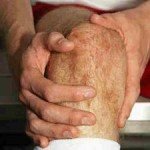 Лечение кисты коленного сустава